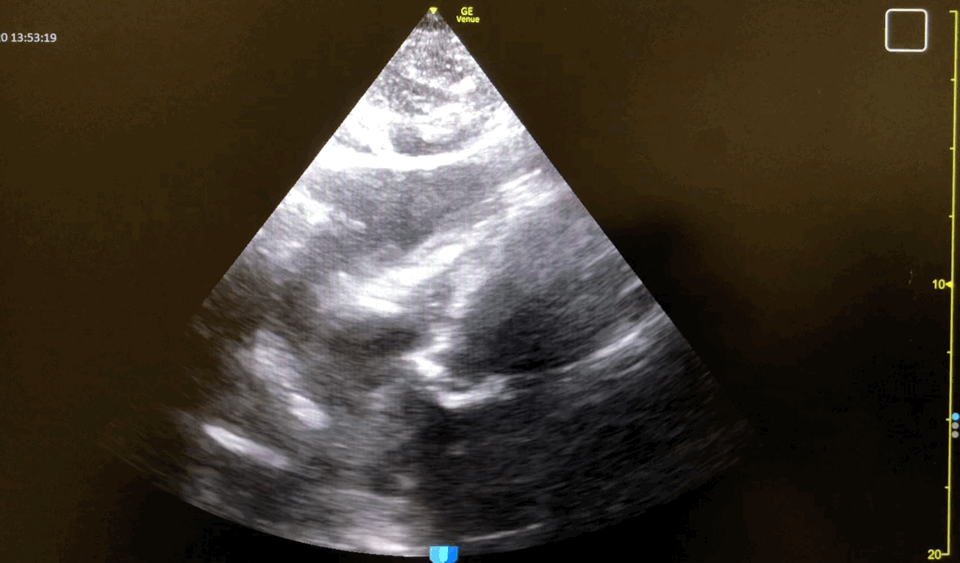 EEU case image missing